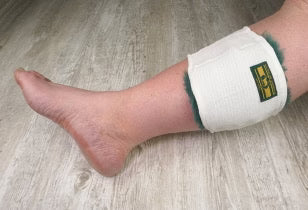 Limb Pressure Guards